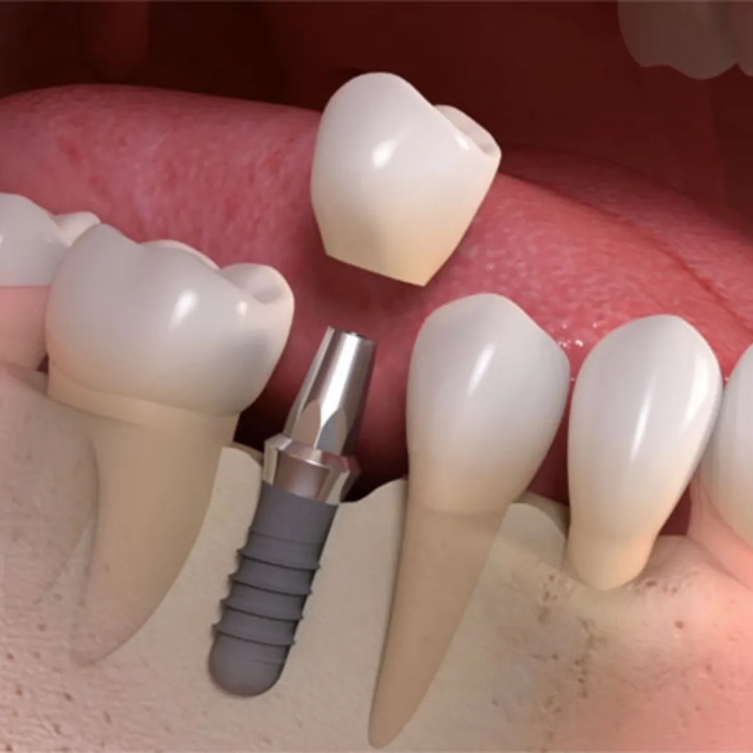 Untitled design 2025 02 17T190451.140 1.png